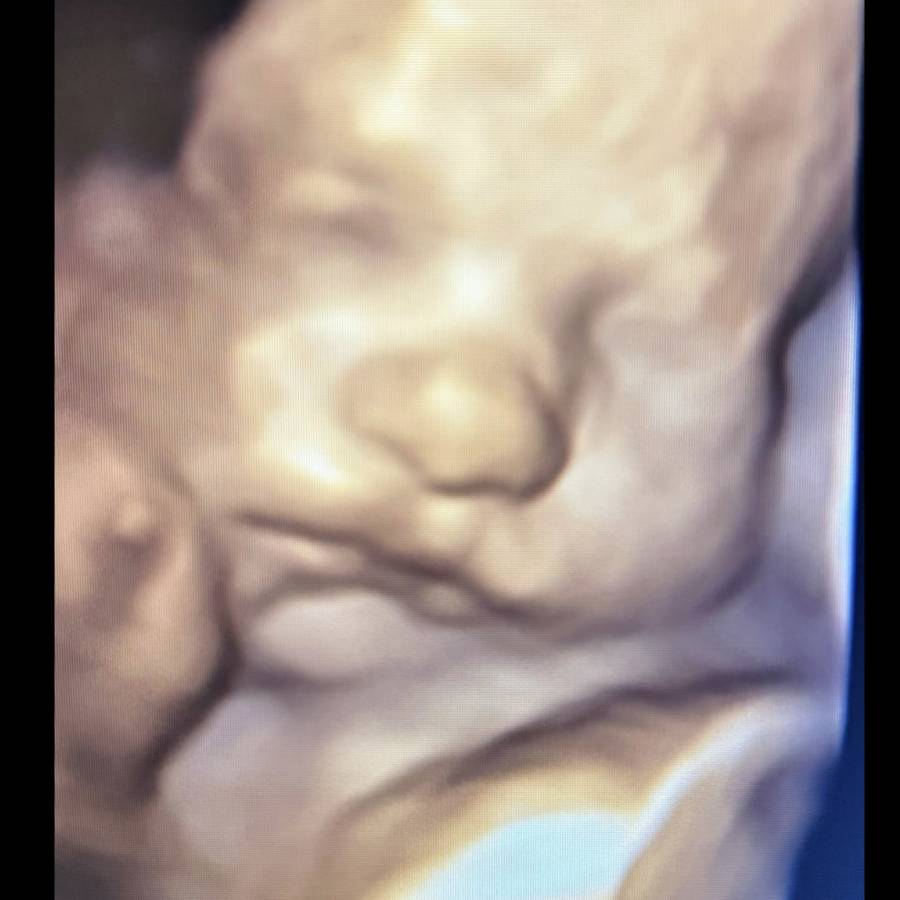 Ultrasound Image Gallery at Beautiful Beginnings Ultrasound Clinic in Shrewsbury, NJ
