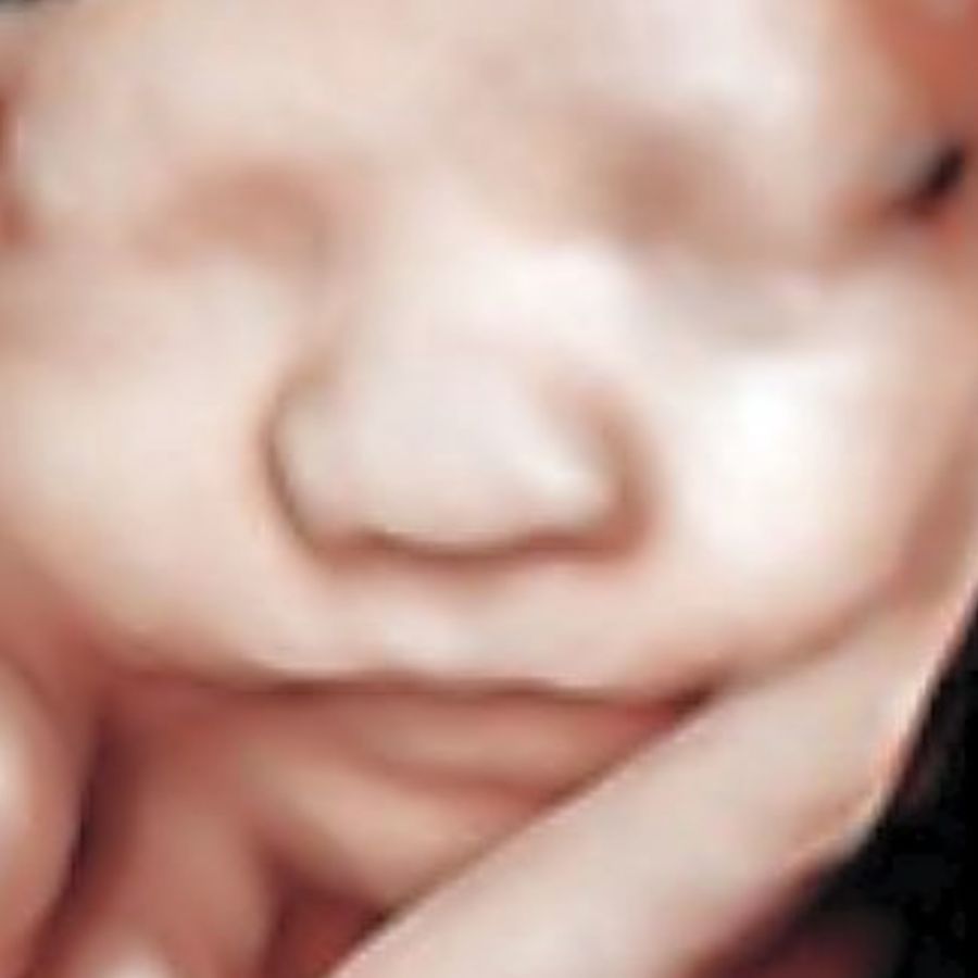 Ultrasound Image Gallery at Beautiful Beginnings Ultrasound Clinic in Shrewsbury, NJ