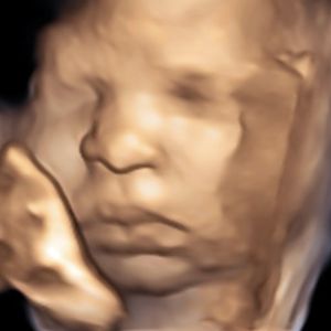 Ultrasound Image Gallery at Beautiful Beginnings Ultrasound Clinic in Shrewsbury, NJ
