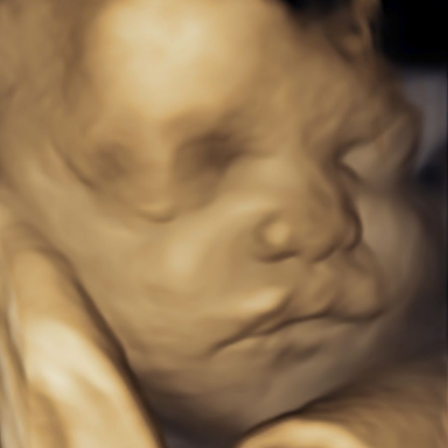 Ultrasound Image Gallery at Beautiful Beginnings Ultrasound Clinic in Shrewsbury, NJ