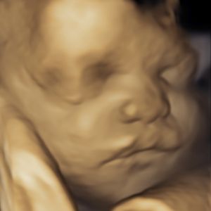 Ultrasound Image Gallery at Beautiful Beginnings Ultrasound Clinic in Shrewsbury, NJ