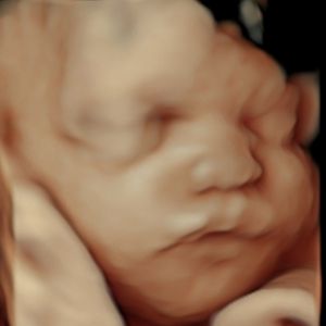 Ultrasound Image Gallery at Beautiful Beginnings Ultrasound Clinic in Shrewsbury, NJ