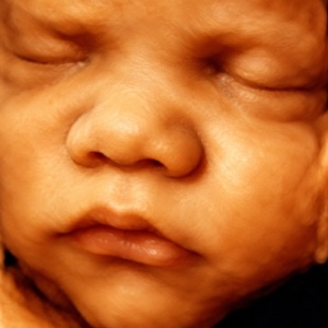 4D Ultrasound Imaging Clinic in Shrewsbury, NJ