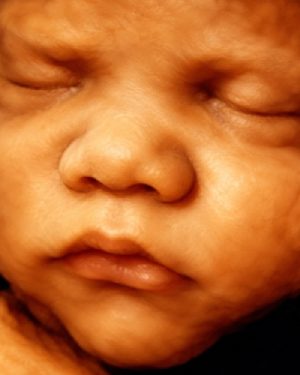 4D Ultrasound Imaging Near Me in Shrewsbury, NJ